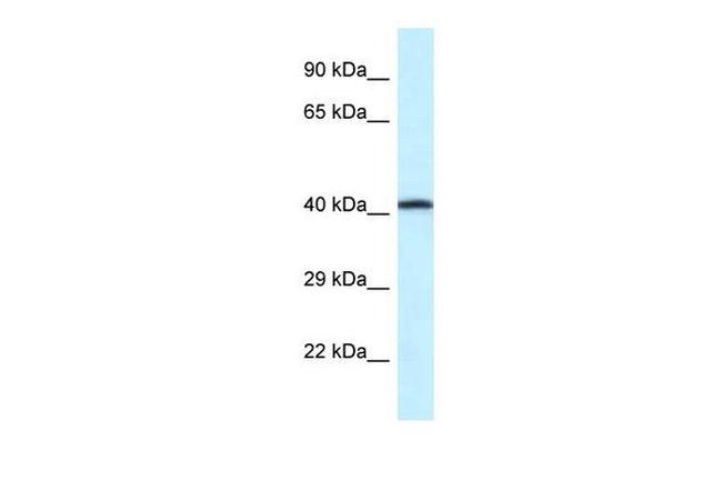 P2X2 Antibody in Western Blot (WB)