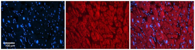 KVbeta2 (KCNAB2) Antibody in Immunohistochemistry (Paraffin) (IHC (P))