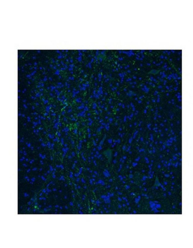 HTR3E Antibody in Immunohistochemistry (IHC)