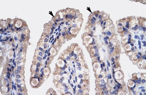 HMGB3 Antibody in Immunohistochemistry (IHC)