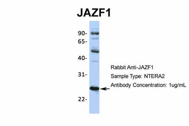 JAZF1 Antibody in Western Blot (WB)