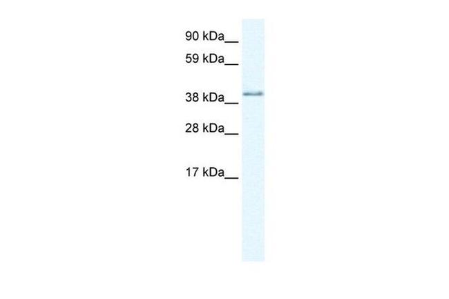 AKAP7 Antibody in Western Blot (WB)