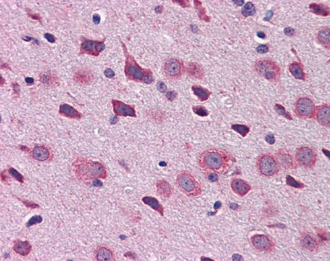 TBR1 Antibody in Immunohistochemistry (IHC)