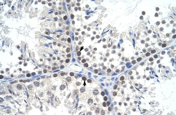 TFAM Antibody in Immunohistochemistry (IHC)