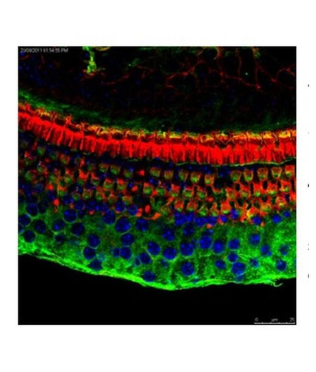 ATF4 Antibody in Immunohistochemistry (IHC)