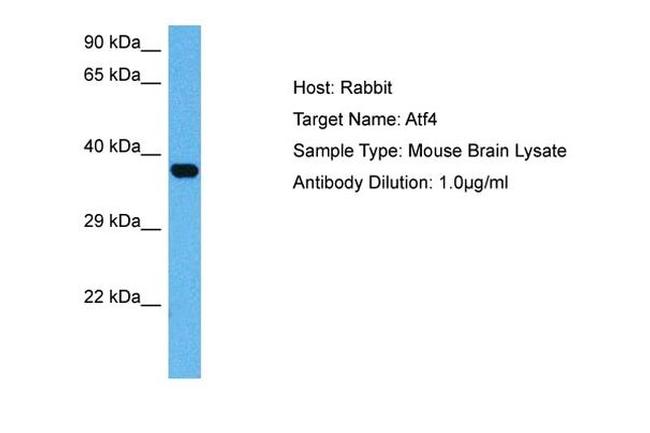 ATF4 Antibody in Western Blot (WB)