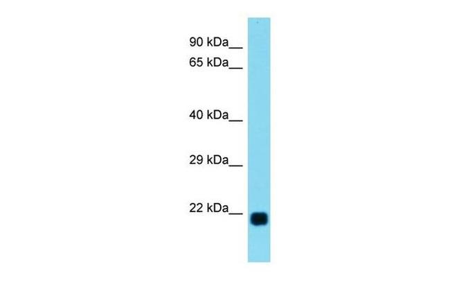 LBX2 Antibody in Western Blot (WB)