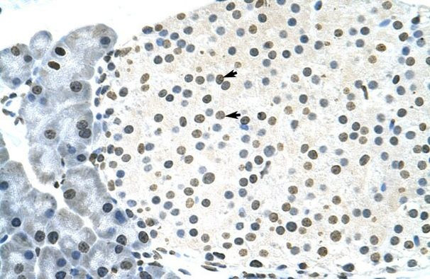 RNF6 Antibody in Immunohistochemistry (IHC)