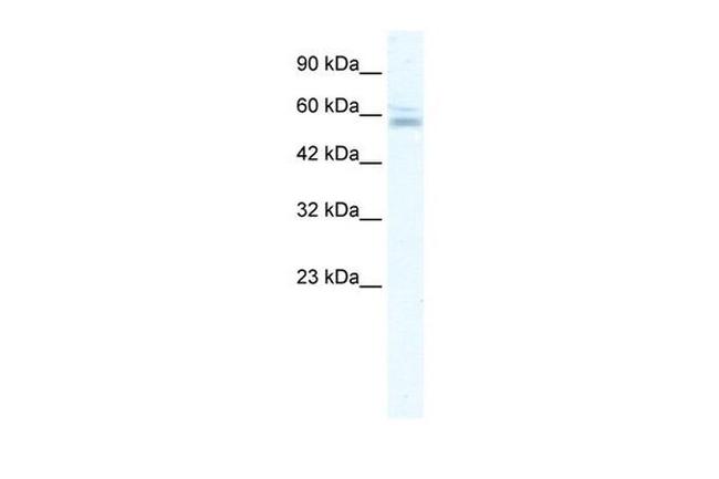 ZNF141 Antibody in Western Blot (WB)