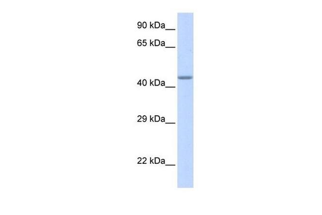 ZNF589 Antibody in Western Blot (WB)