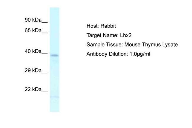 LHX2 Antibody in Western Blot (WB)