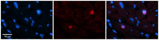 LBX1 Antibody in Immunohistochemistry (Paraffin) (IHC (P))