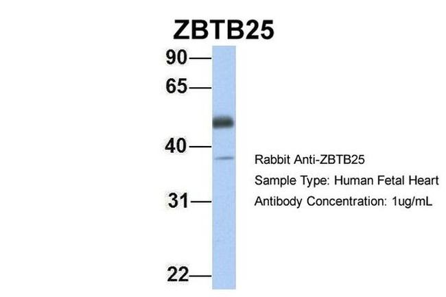 ZBTB25 Antibody in Western Blot (WB)