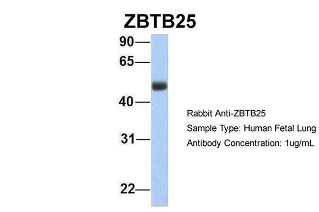 ZBTB25 Antibody in Western Blot (WB)