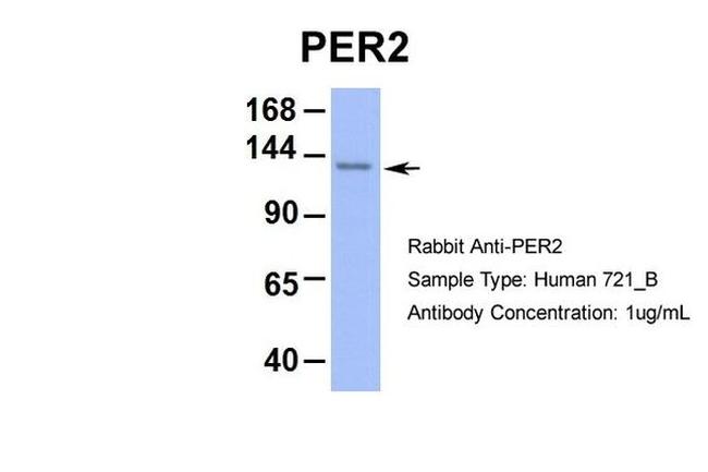 PER2 Antibody in Western Blot (WB)