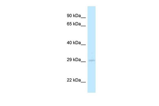 4933408B17Rik Antibody in Western Blot (WB)