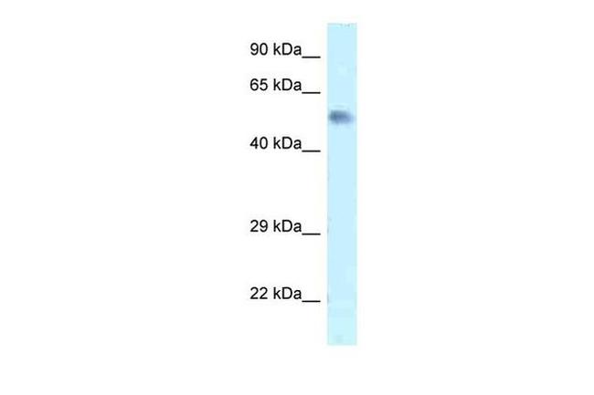 Zfp472 Antibody in Western Blot (WB)