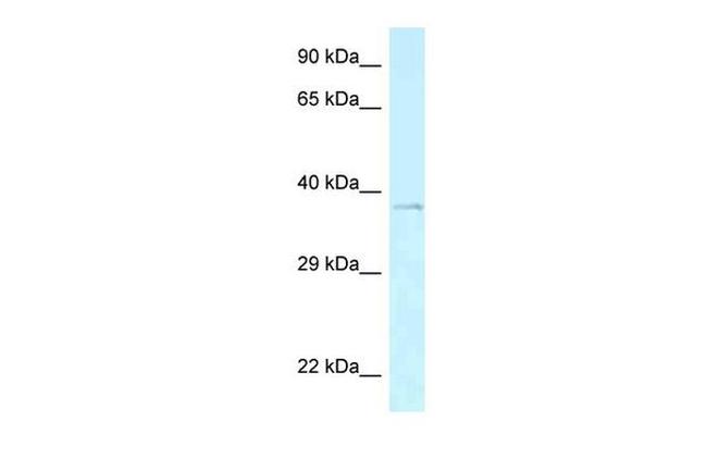 AEBP2 Antibody in Western Blot (WB)