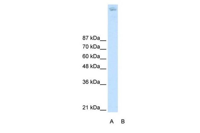 ZBTB38 Antibody in Western Blot (WB)