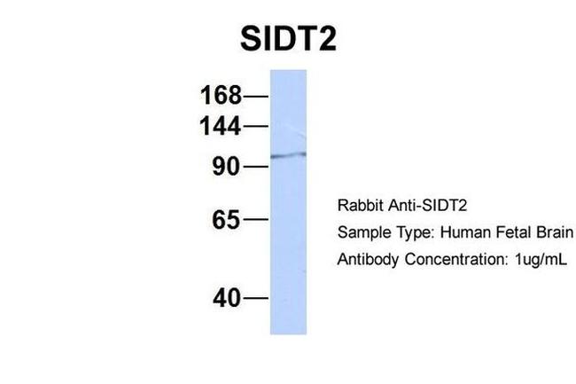 SIDT2 Antibody in Western Blot (WB)