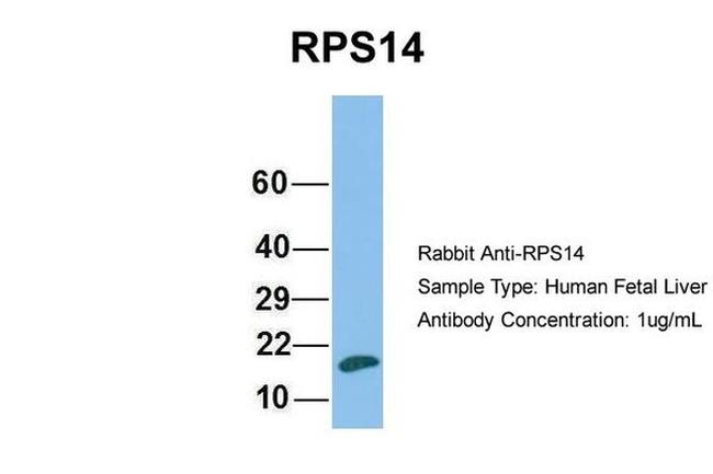 RPS14 Antibody in Western Blot (WB)