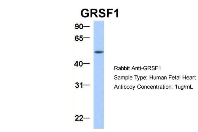 GRSF1 Antibody in Western Blot (WB)