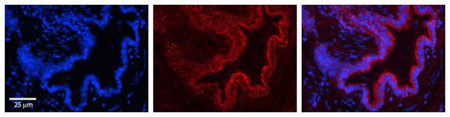 PIGF Antibody in Immunohistochemistry (Paraffin) (IHC (P))