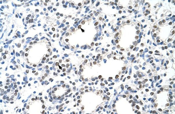 Nuclear Matrix Protein p84 Antibody in Immunohistochemistry (Paraffin) (IHC (P))