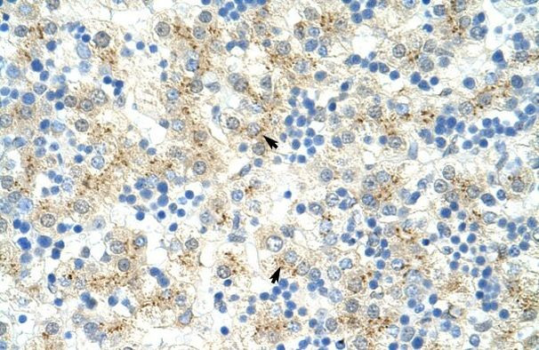 EXOSC6 Antibody in Immunohistochemistry (Paraffin) (IHC (P))