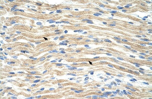 EXOSC6 Antibody in Immunohistochemistry (Paraffin) (IHC (P))