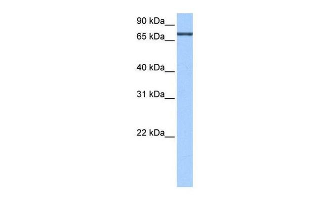 ADAD2 Antibody in Western Blot (WB)