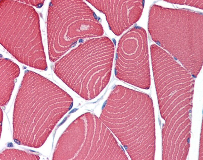 MYH7 Antibody in Immunohistochemistry (IHC)