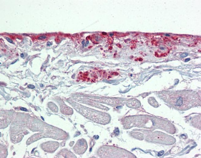 Periostin Antibody in Immunohistochemistry (Paraffin) (IHC (P))