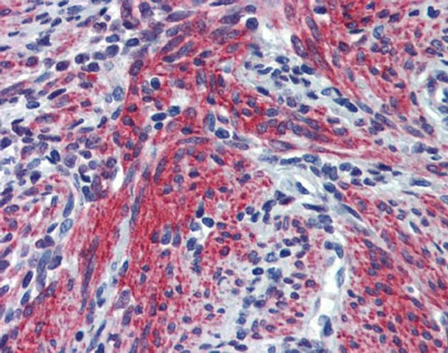 Periostin Antibody in Immunohistochemistry (Paraffin) (IHC (P))