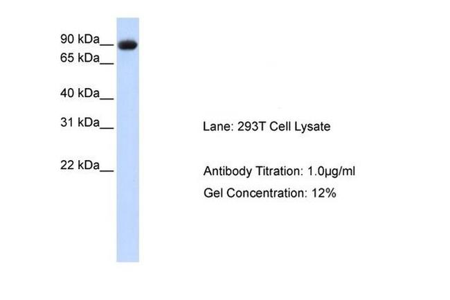 Periostin Antibody in Western Blot (WB)