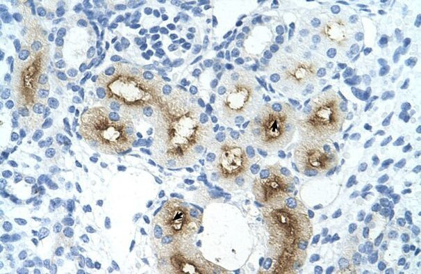 GGTLC1 Antibody in Immunohistochemistry (IHC)