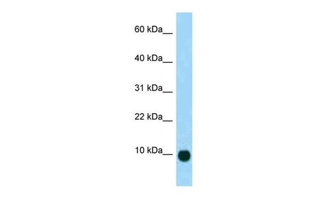 Secretin Antibody in Western Blot (WB)