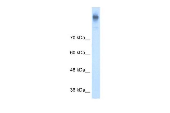 NKCC1 Antibody in Western Blot (WB)