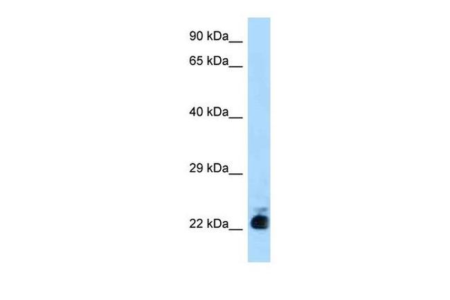 CTR1 Antibody in Western Blot (WB)