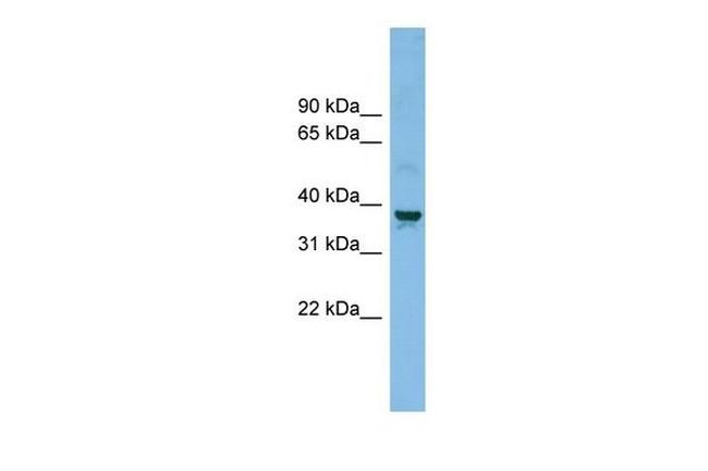 SLC30A3 Antibody in Western Blot (WB)