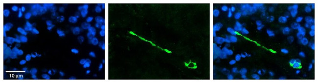 MTUS1 Antibody in Immunohistochemistry (Paraffin) (IHC (P))