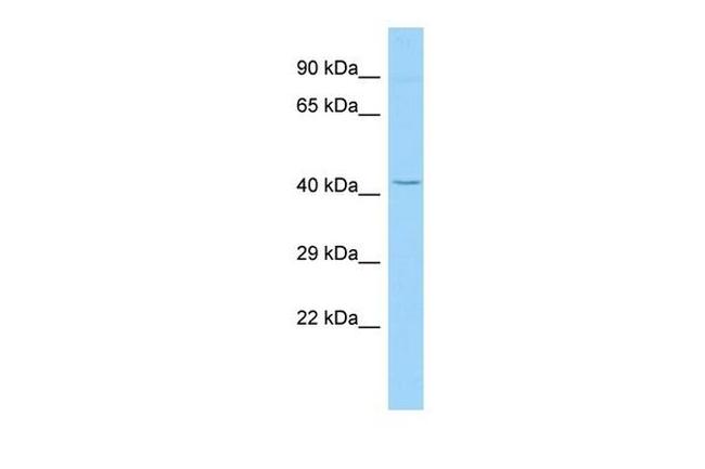 Tecrl Antibody in Western Blot (WB)