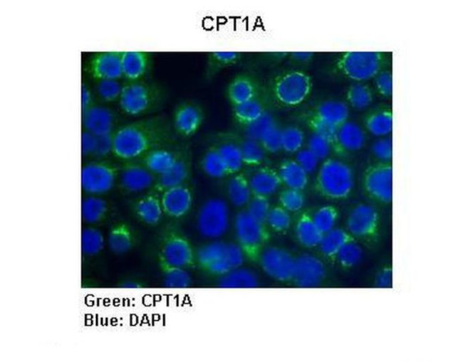 CPT1A Antibody in Immunohistochemistry (IHC)