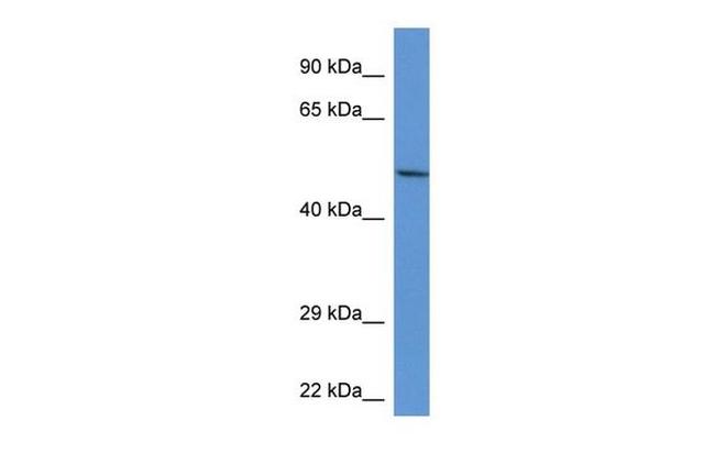 Acid Phosphatase 2 Antibody in Western Blot (WB)