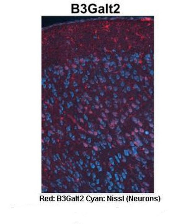 B3GALT2 Antibody in Immunohistochemistry (IHC)