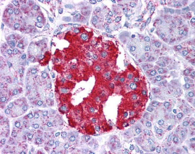 GluD1 Antibody in Immunohistochemistry (IHC)