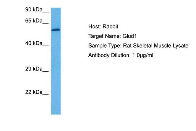 GluD1 Antibody in Western Blot (WB)