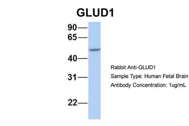 GluD1 Antibody in Western Blot (WB)