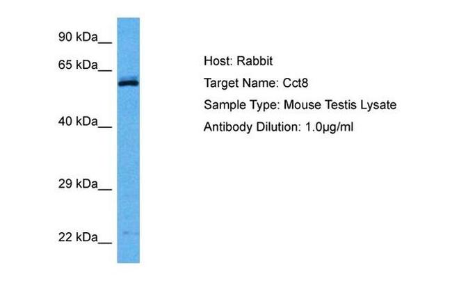 TCP-1 theta Antibody in Western Blot (WB)