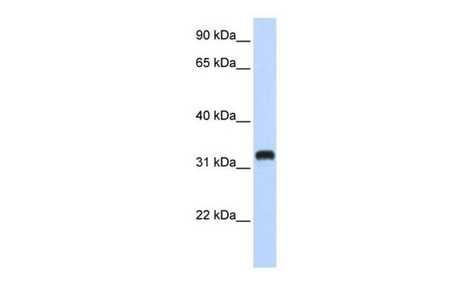 C21orf62 Antibody in Western Blot (WB)